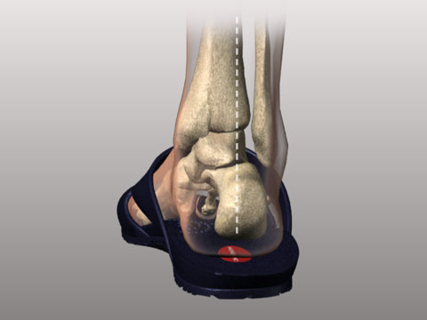 image showing non-pronated foot in Okabashi shoe